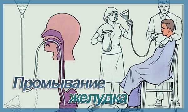 промывка желудка