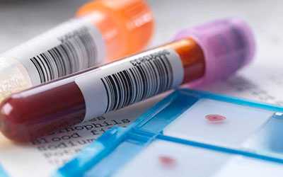 Алкоголизм по маркеру CDT - Веримед