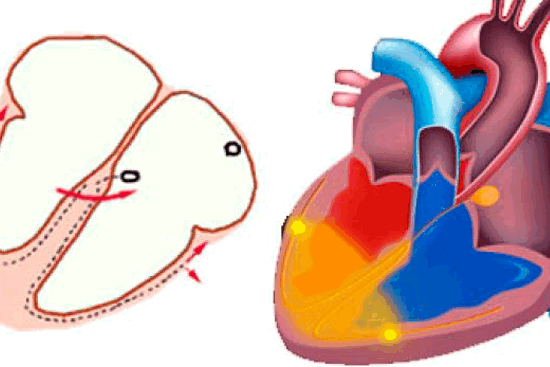 Блокада ножки Гиса