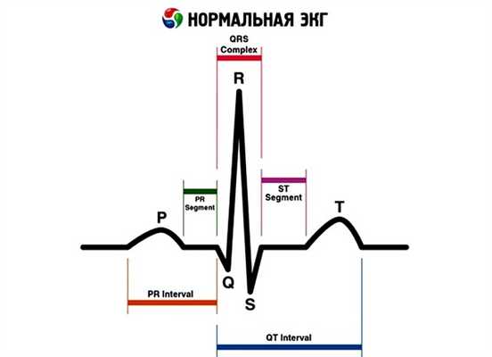 Нормы ЭКГ при ишемической болезни сердца