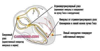 блокада-левой-ножки-гиса2