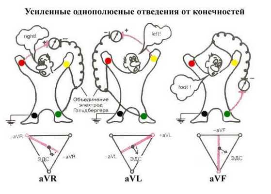 Схема формирования усиленных отведений