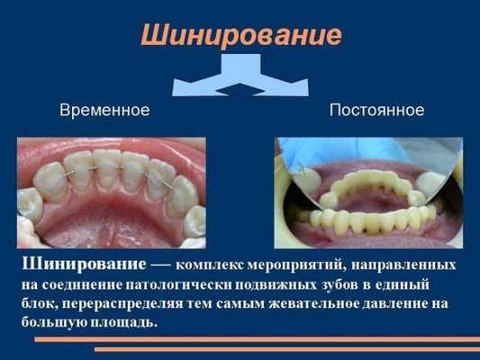 Постоянное и временное шинирование