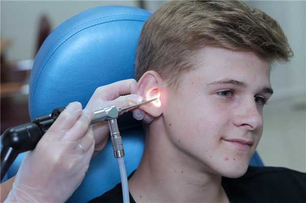 Экзостозы наружного слухового прохода как причина образования серных пробок