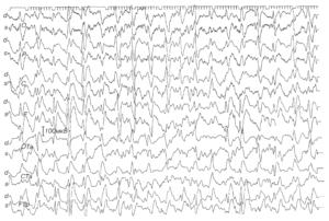 Периодические комплексы