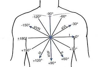 Что такое электрическая ось сердца