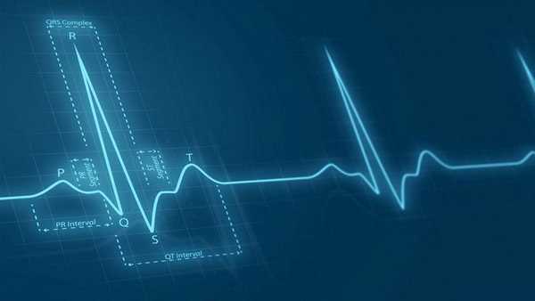 Нормальная ЭКГ