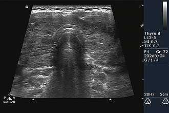 Исследование щитовидки