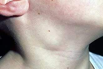 Какие болезни диагностируются