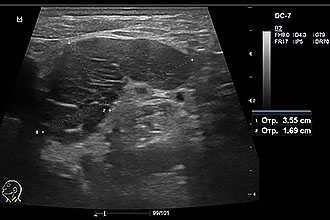 Что показывает