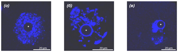 Различная конфигурация хроматина