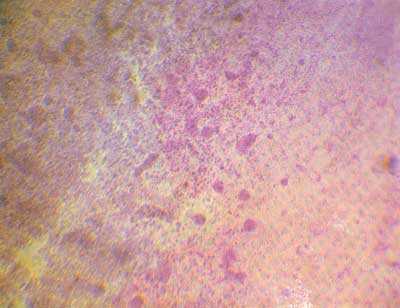 Рис.1а. Развитие первичной сети сосудов. Тотальный препарат.