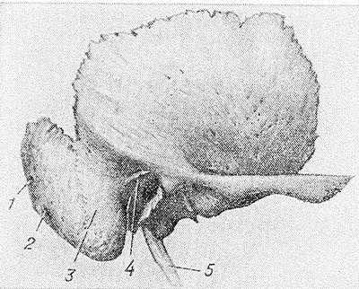 Рис. 1. Макропрепарат височной кости: 1 — сосцевидное отверстие; 2 — сосцевидная вырезка; 3 — сосцевидный отросток; 4 — надпроходная ость; 5 — шиловидный отросток.