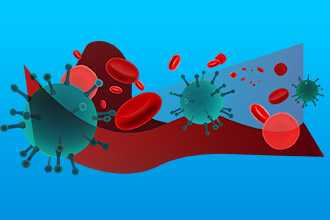 Общие признаки инфекционного процесса