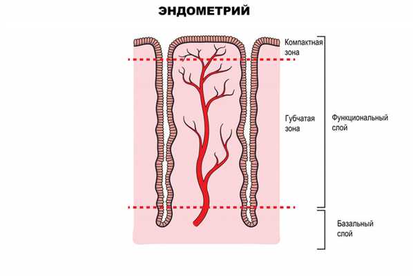 Послеродовой эндометрит
