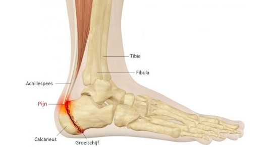 Подготовка к артродезу