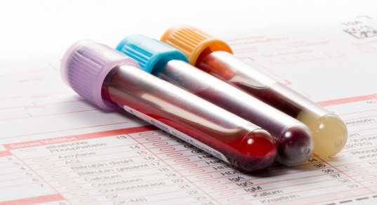 Подготовка к операции