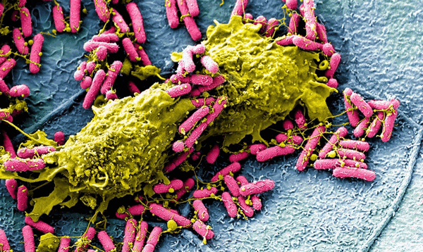 Раскрашенное изображение (полученное с помощью РЭМ) уропатогенных Е. coli, эпителия и нейтрофилов
