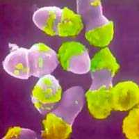 Enterococcus faecium