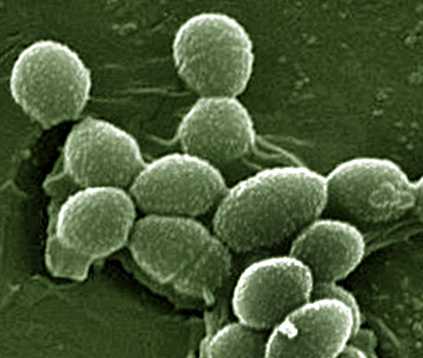 Enterococcus faecalis