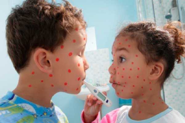 Детские инфекции