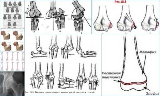 Классификация болезни по развитию
