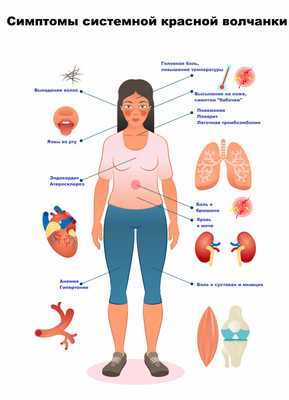 Дискоидная красная волчанка