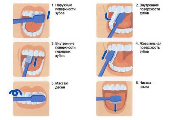 Техника чистки зубов