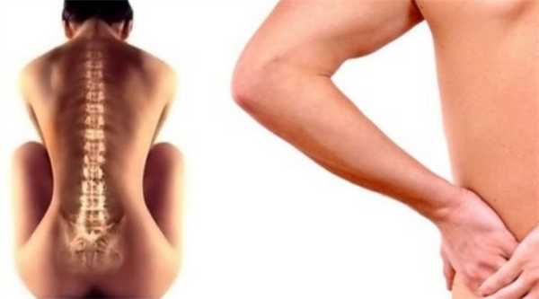 Боль в спине в области поясницы