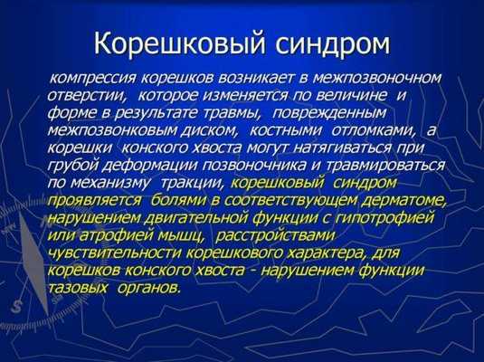 Корешковый синдром