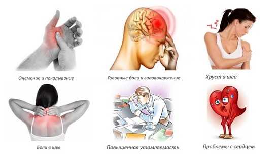 Остеохондроз и спондилез имеют схожий шейный болевой синдром