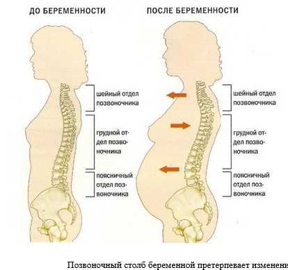 Боли в спине и пояснице у женщины
