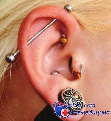 прокалывание ушей