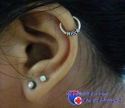 прокалывание ушей