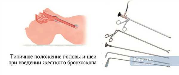 Жесткий (ригидный) бронхоскоп купить в Юни-тек