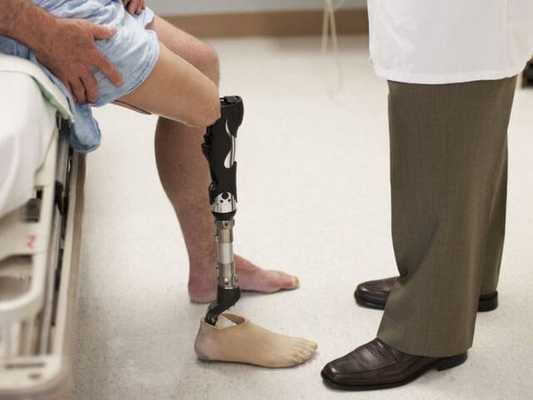 Ампутация нижних конечностей