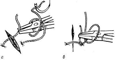 Рис. 4. Схематическое изображение инструментального (аподактильного) способа завязывания хирургического узла: а — после выкола иглы длинным концом нити обернут иглодержатель, которым захватывают короткий конец нити; б — после затягивания первой петли длинный конец нити обернут вокруг иглодержателя в противоположном направлении (иглодержателем фиксирован короткий конец нити для затягивания второго узла).