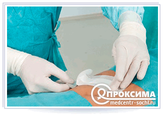 Методика первичной хирургической обработки