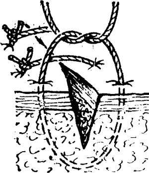 Рис. 1. Схематическое изображение наложения простого узлового шва на линейную кожную рану.