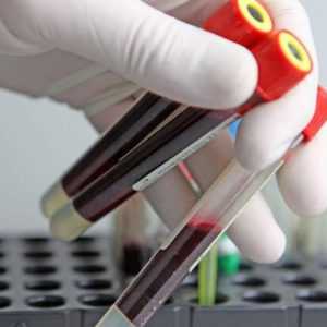 Общий анализ крови