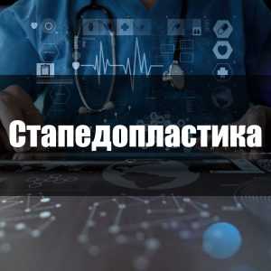 Стапедопластика