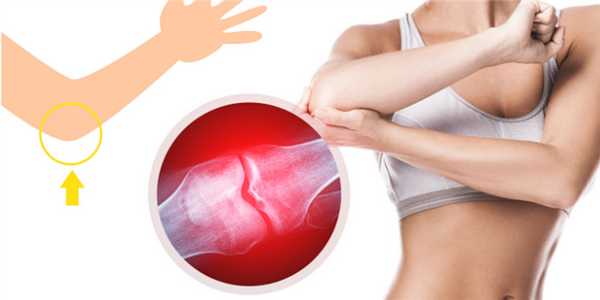 Симптомы бурсита локтевого сустава