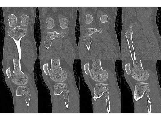 КТ-сканы до операции