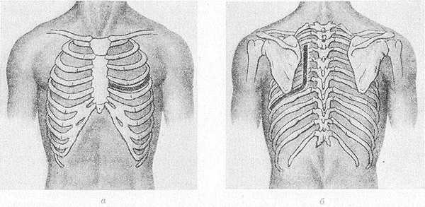 Рис. Схематическое изображение кожных разрезов (черные линии) при торакотомии: а — при переднебоковом доступе (кожный разрез в четвертом межреберье от парастернальной до передней подмышечной линии); б — при заднебоковом доступе (кожный разрез, окаймляющий лопатку, проходит от уровня III—IV грудных позвонков до средней подмышечной линии на уровне VII ребра).