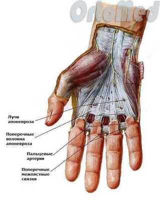 Контрактура Дюпюитрена
