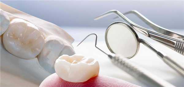 Как правильно ухаживать за мостовидными протезами