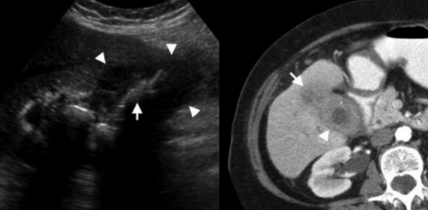 Снимок экрана 2016-04-20 в 21.53.34