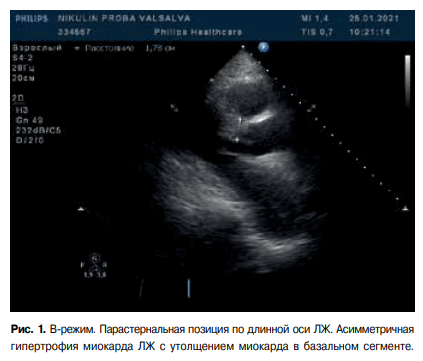 Изображение статьи