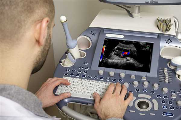 Трансректальное УЗИ