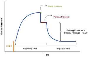 Роль постоянного положительного давления в конце выдоха в лечении пациентов с коронавирусной инфекцией